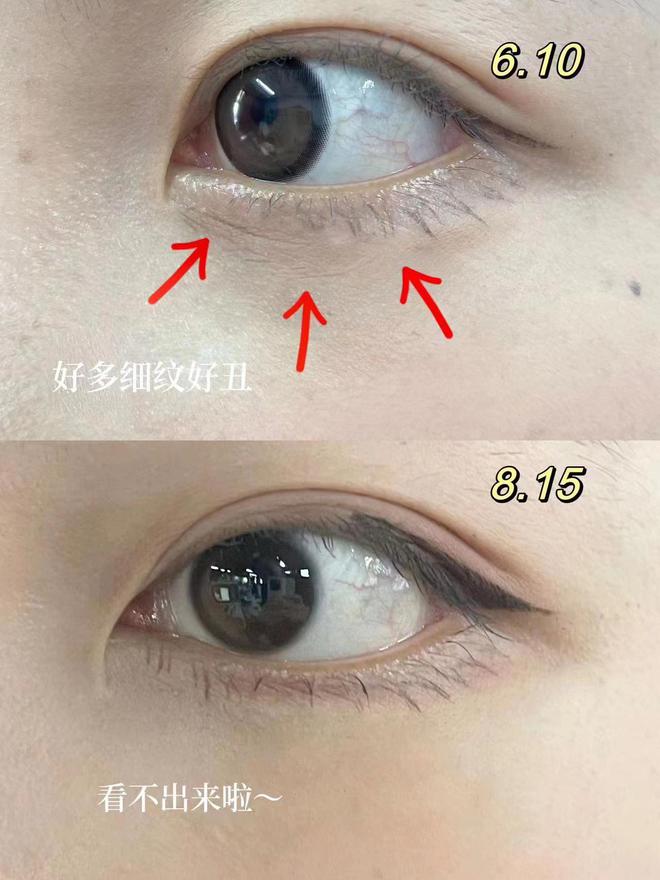 眼霜！熬夜测评总结十大眼霜品牌揭秘AG真人国际去眼袋公认最好用10大(图9)